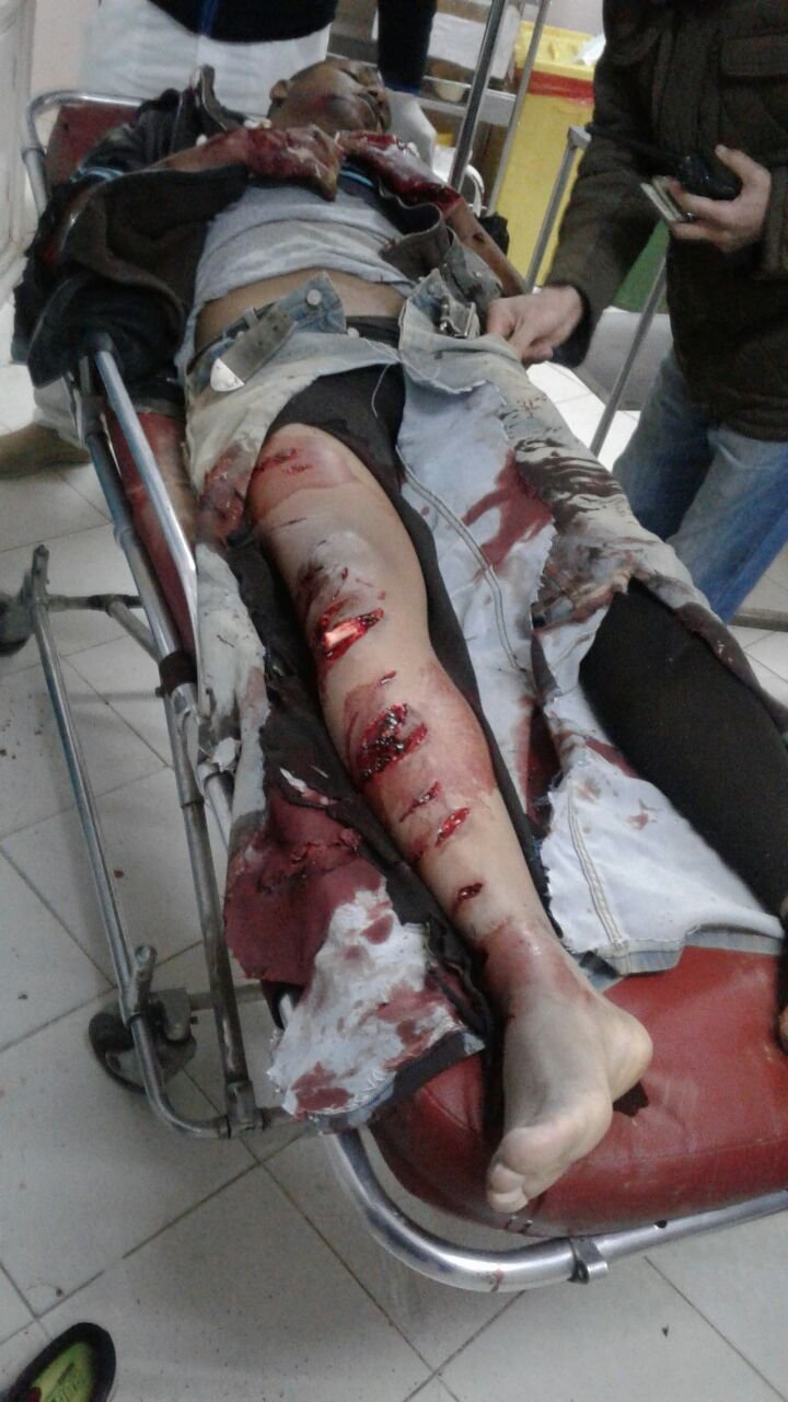 عاجل:مواجهة دامية خارج اسوار الحي الجامعي بالرشيدية