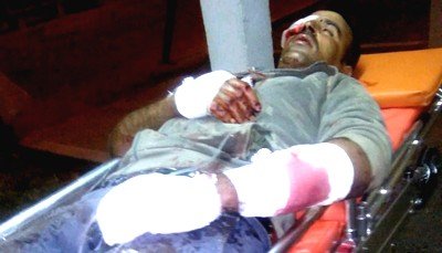  محاولة قتل أدّت إلى إحداث عاهة مستديمة وفقدان للبصر والجناة أحرار طلقاء