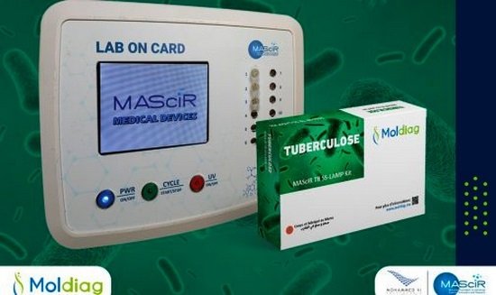 ” Moldiag” تطلق أول اختبار تشخيصي لداء السل مغربي 100٪