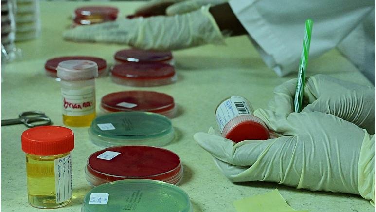 منظمة الصحة العالمية توصي أوكرانيا بتدمير مسببات الأمراض الخطرة