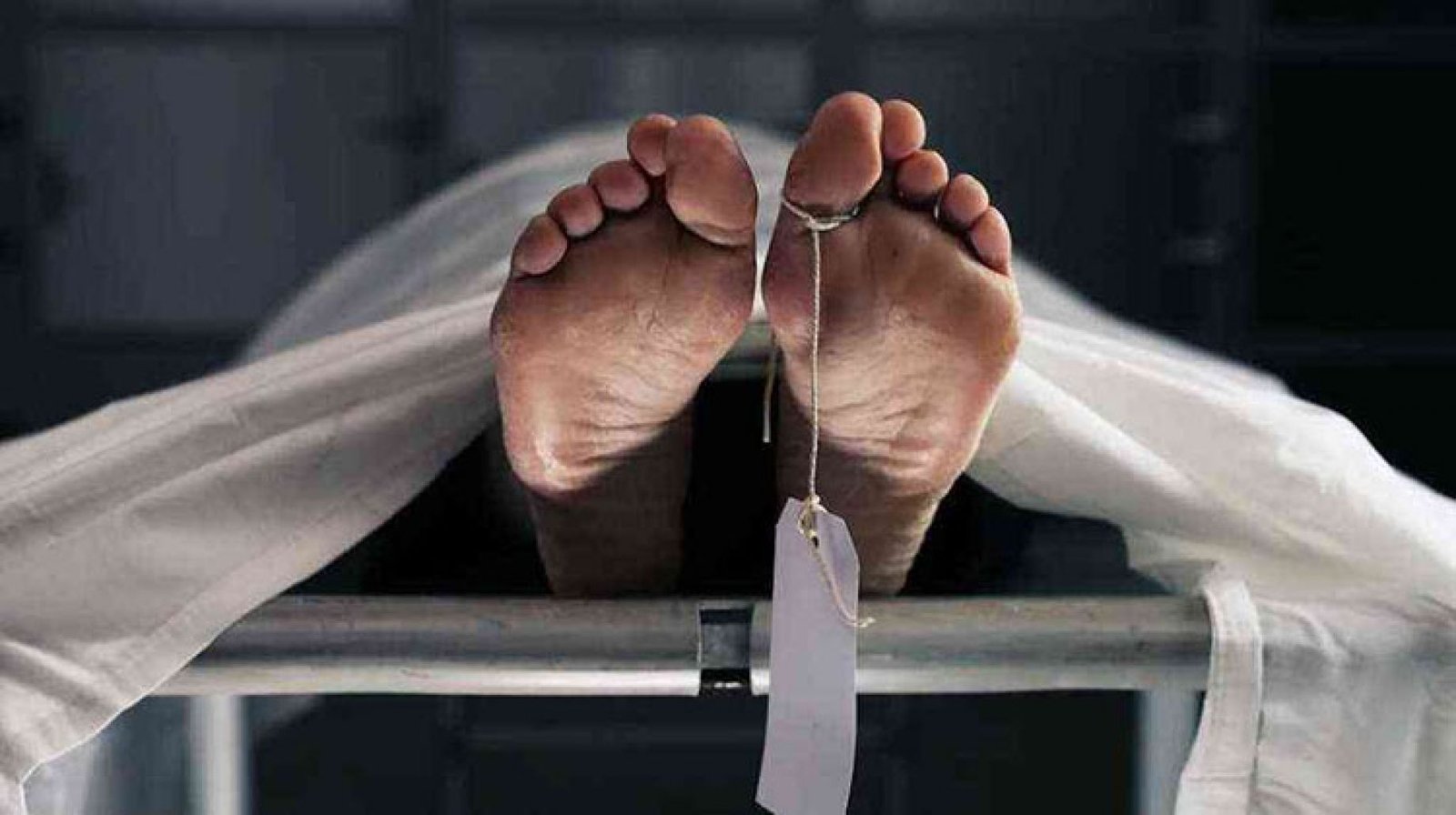 دخل لإجراء عملية زرع شعر فخرج جثة هامدة