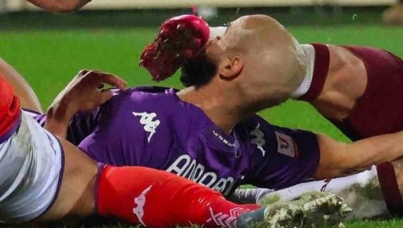 إصابة أمرابط بكسر تثير القلق في فيورنتينا