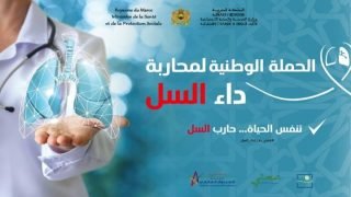 وزارة الصحة والحماية الاجتماعية تطلق الحملة الوطنية للوقاية من داء السل