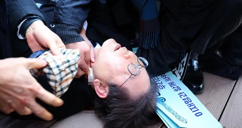 زعيم المعارضة الكورية يتعرض لاعتداء بالطعن