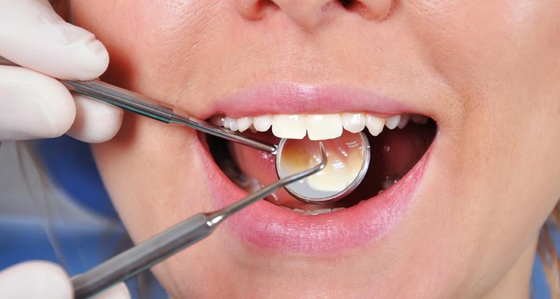 3 ممارسات شائعة تؤدي إلى اصفرار أسناننا