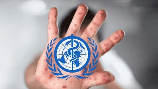 منظمة الصحة العالمية تطلق خطة إستراتيجية عالمية لإحتواء تفشي جدري القردة