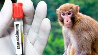 الهند تعلن تسجيل أول حالة إصابة بمرض جدري القردة