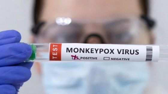 الإعلان عن تطوير واعتماد طقم جديد لتشخيص جدري القردة