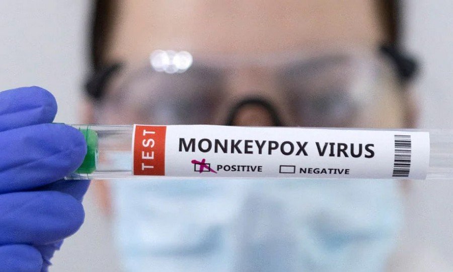 الإعلان عن تطوير واعتماد طقم جديد لتشخيص جدري القردة