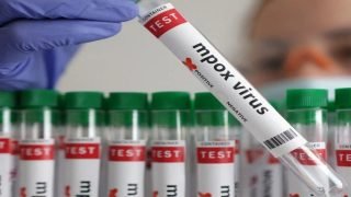 بعد السويد.. متغير جدري القردة الجديد يصل إلى ألمانيا