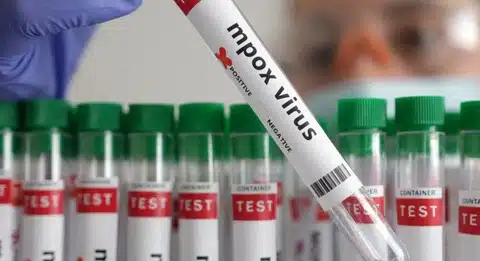 دولة إفريقية جديدة تعلن تسجيل أول حالتي إصابة بفيروس جدري القردة