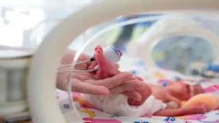 فصل أربع توائم ملتصقة بالمغرب تكللت جميعها بالنجاح