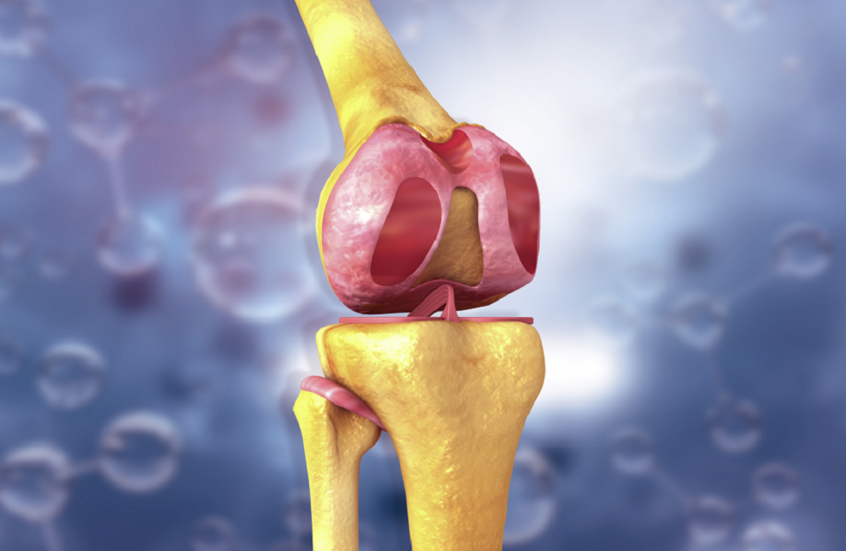 دراسة تتحدث عن نقلة نوعية في جراحة العظام